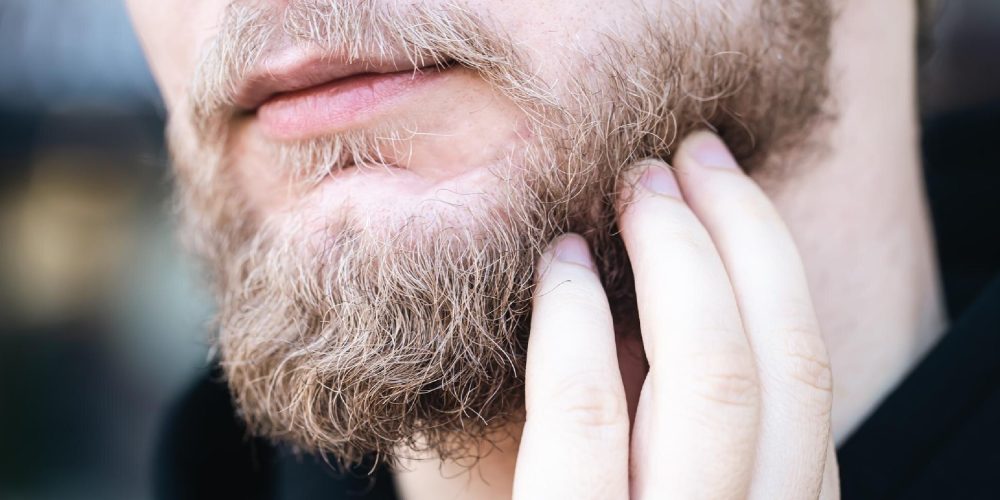 Sakalda Kepeklenme Nedir? Neden Olur?